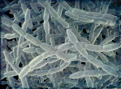 Acting NYC health commissioner defends city's communications on Legionnaires’ disease